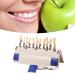 Tooth Bleaching Shade Chart Teeth Whitening Shade 29 Colors Comparison Individually Removable Tooth Bleaching Shade Chart