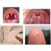 Tonsil Stone Remover Tool LED Light Earpick Stainless Steel Earwax Remover Oral Care Clean - Buy Online on GoSupps.com