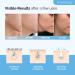 Dead Sea Mud Mask with Hyaluronic Acid for Men and Women - Deep Cleansing and Pore Minimizing Skin Care - 8.1oz - Buy Online on GoSupps.com
