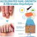 Onyxoguard Nail Growth And Repair Serum Onyxoguard Serum Nail Growth And Strengthener Nail Growth And Repair Serum Nail Growth Polish Nail Strengthener For Thin Nails And Growth (1PCS) - Buy Online on GoSupps.com