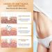 Underarm Whitening Cream Underarm Whitening Cream Lightening Cream for Armpits Elbows Inner Thighs Knees and Body 60 ml - Buy Online on GoSupps.com