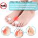 Bunion Pads Toe Separators Corrector for Bunions Pain Relief - 4PCS White | Toe Alignment Spacer Shield for Calluses Corns in Women and Men - Buy Online on GoSupps.com