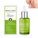 MCTEST Goopgen Scar Repair Serum with Natural Ingredients and Vitamin E - Reduce The Appearance of Scars in All Skin Types - 30ml-1Pcs