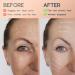Face Lifting Tape & Anti-Wrinkle Patches - Multifunctional Skin Tightening Rollers - 1 Pack - Buy Online on GoSupps.com