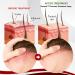 LELEBEAR Dermax Psoriasis Treatment Spray - Soothes Skin, Stops Burning and Itching (5 Pack) - Buy Online on GoSupps.com