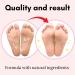 Perorin Lavender Scented Foot Peeling Socks - Buy Online on GoSupps.com