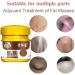 Wokii 3PCS Lipoma Removal Cream Lipoma Treatment Huangfutang Lipoma Removal Miaozu Huangfutang Lipoma Removal Cream Safe and Effective - Buy Online on GoSupps.com