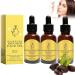 Frankincense Resin Oil For Face Frankincense Resin Infused Organic Black Seed Organic Black Seed Castor & Jojoba Oils Cold Pressed Serum Hydrates Skin Anti-Aging Wrinkle