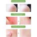Bite Relief Soothing Balm | Natural Itch Cream Itch Relief Ointment Itch Relief Pen for All Skin Types Fast Acting Relief for Itches Bites and Redness Uitseld - Buy Online on GoSupps.com