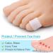 Gel Toe Cap and Protector - Prevent Ingrown Toenails, Corns, Blisters, Hammer Toes - 8 Pairs - Buy Online on GoSupps.com