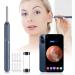 Ear Wax Removal Tool - Sleek Design for Small Ears | HT-P20 (US Plug) - Buy Online on GoSupps.com
