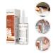 Lurrose Nail Repairing Serum 20ml - Onychomycosis Softening Solution for Discolored Nails - Nails Treatment Oil for Damaged Nails - Buy Online on GoSupps.com