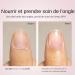 Nail and Cuticle Oil - 15ml Repair Care For Damaged Nails | Nourishing Care For Cracked Nails Compact Cuticle Care Product For Travel - Buy Online on GoSupps.com