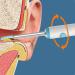 WiFi Smart Earwax Removal Tool with HD Visuals - Safe & Efficient Cleaning - Buy Online on GoSupps.com