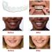 Fake Teeth Veneers Dentures - Cosmetic Tooth Repair Kit for Men and Women | Protect Your Teeth and Regain Confidence - Buy Online on GoSupps.com