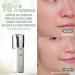 TRUU 99 Oil-Control Moisture Balancing Cream | Hydrating & Oil-Regulating Formula | Reduces Pores & Enhances Brightness | 1.8 Oz - International Shipping Available - Buy Online on GoSupps.com