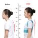 Back Posture Corrector Shoulder Lumbar Wasit Support Correction for Kids Teens Straighten Upper Belt Blue XL Size - Buy Online on GoSupps.com