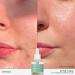 REN Clean Skincare Evercalm Barrier Support Elixir - Soothing Serum - Buy Online on GoSupps.com