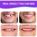Buy Flipped Warm 2 Pairs of Artificial Teeth | Prosthetic Temporary Dentures & Cosmetic Veneers - International Shipping Available - Buy Online on GoSupps.com