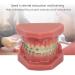 Orthodontic Bracket Model - Dental Resin Model & Portable Metal Wire for Student Learning - Buy Online on GoSupps.com