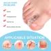 HDYS 2x Toe Spreader - Bunion Corrector & Hallux Valgus Foot Care Protector for Perfect Pedicure | International Shipping Available - Buy Online on GoSupps.com