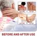 Bienengiftsalbe Bee Venom Cream for Pain Relief - 2PCS Arthrosis Treatment | Todahof International Shipping - Buy Online on GoSupps.com