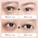  homomdy Turmeric and retinol eye cream - For dark circles and puffy eyes - Anti-wrinkle eye cream - Reduces fine lines - Anti-aging - Firming and lifting - Moisturizing - Buy Online on GoSupps.com