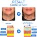 |Most Gifted| Age Reverse Ampoule Serum - 2024 New Anti-Aging Regenerative Ampoule Serum - Anti Aging Face Serum - Firm Skin and Reduce Wrinkles - Rejuvenate Youthful Skin (3Box - 90Pcs) - Buy Online on GoSupps.com
