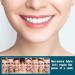 Buy Provisional Dentures - 2 Pairs of Realistic Fake Teeth for a Beautiful Smile | Artificial Teeth for Men & Women | International Shipping Available - Buy Online on GoSupps.com