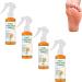 Spray peeling pour les pieds l'huile d'orange limine les peaux mortes lisse les pieds secs et fissur s pour les mains et les articulations le genou la cheville le coude (4PCS)