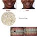 2pcs 50g False Teeth Solid Glue Kit - Temporary Tooth Replacement & Repair Adhesive - Buy Online on GoSupps.com