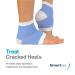 NatraCure Intensive Moisturizing Gel Heel Sleeves - Blue (1 Pair) - Buy Online on GoSupps.com