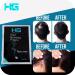 Hair Genetics Hair Fibres White 22g Refill Pack - Effective Solution for Hair Loss and Thinning - 22g (Pack of 1) White - Buy Online on GoSupps.com