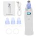 Xcello USB Charging Electric Blackhead Remover Machine Intelligent Pore Cleaner for Face