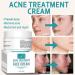 Acne B-Gone Moisturizer Cream - Tea Tree Oil Nighttime Treatment for All Skin Types Fights Pimples Overnight - Buy Online on GoSupps.com