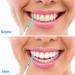 Ultra Narrow Interdental Brush - 160 Disposable Silicone Toothpicks for Effective Dental Cleaning - Green - Buy Online on GoSupps.com