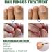 Antifungal Nail Treatment for Damaged Nails - Toe Care Solution for Renewing Discolored Feet - Buy Online on GoSupps.com