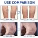 EXQST Mucopolysaccharide cream with polysulfuric acid Cream Varicose Veins Repair Cream for Legs Earthworm Varicose Veins - Buy Online on GoSupps.com