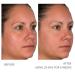 Serious Skincare A Force XR Retinol Serum 1oz - Anti-Aging & Anti-Wrinkle Treatment with Time Released Vitamin A & Green Tea Extract - Buy Online on GoSupps.com