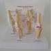 Dog Knee Joint Model Four Stage Knee Arthritis Health Knee and Dog Lesion Joint Model for Veterinary Office Teaching Aids - Buy Online on GoSupps.com