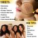 Barrier Repair 96% Snail Mucin Serum | Niacinamide & Hyaluronic Acid for Acne Redness Large Pores | Vegan Korean Skincare | Ultra Smooth Radiant Skin - Buy Online on GoSupps.com