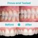 Furzero Oral Gum Treatment Gel Dentizen Gum Therapy Gel Furzero Gum Therapy Gel Gum Shield Therapy Gel Furzero Teeth Whitening Repair Regrowth Gel (4pcs) - Buy Online on GoSupps.com