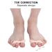 Small Toe Separator - ANGGREK 7 Pairs 3-Hole SEBS Hallux Valgus Toe Corrector Tool for Pain Relief & Skin Brightening - Buy Online on GoSupps.com