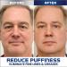 Openeyes Awaken Peptide Lifting Eye Gel Nordizoe Openeyes Awaken Peptide Lifting Eye Gel nordizoe openeyes Lifts Firming Anti-wrinkle Eye Tightener Men Eye Cream Anti Aging (5Pcs) - Buy Online on GoSupps.com