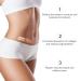 Silicone Scar Patch Roll - Professional Scar Removal Tape for Surgery, Burns, Keloid - 1.6 x 120 Roll - Buy Online on GoSupps.com