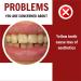 Dazzling White Toothpaste - Fresh Breath Stain Removal & Enamel Repair with Niacinamide | International Shipping - Buy Online on GoSupps.com