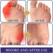 Buy 48 Herbalbase Japanese Bale Toe Patches | Pain Relief for Inflamed Balls | Anti-Bale Toe Patch | Fast International Shipping - Buy Online on GoSupps.com