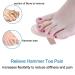 Toe Straightener - Hammer Toe Corrector & Protector Insoles for Men & Women | Foot Care Tool (Pack of 3 - Buy Online on GoSupps.com