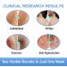 Yakitoko Vitiligo Treatment - Natural Cream for Skin Vitiligo & Leukoplakia | Best International Shipping - Buy Online on GoSupps.com