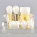 Dental Model Dentist Dental implant Model Resin Material Removable Used for Dental Clinic Research and Doctor-Patient Communication - Buy Online on GoSupps.com